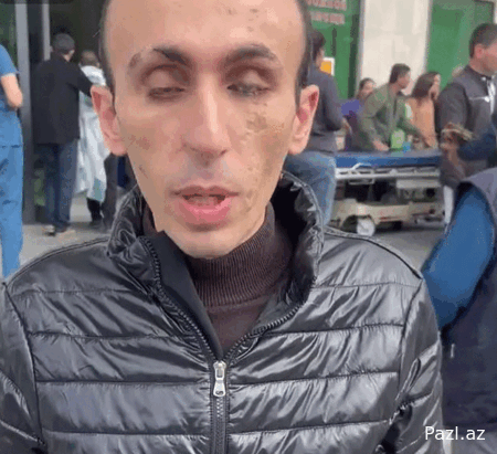 Словно пенис на лбу Армении